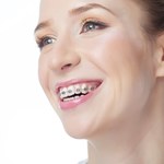 Coraz więcej dorosłych decyduje się na leczenie ortodontyczne. Czy to nie za późno?
