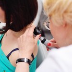 Coraz więcej przypadków czerniaka w Polsce. Zdradza go kilka zmian