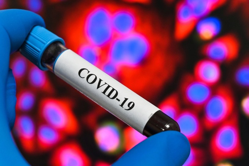 COVID-19 może przyczyniać się do rozwoju choroby Parkinsona /123RF/PICSEL