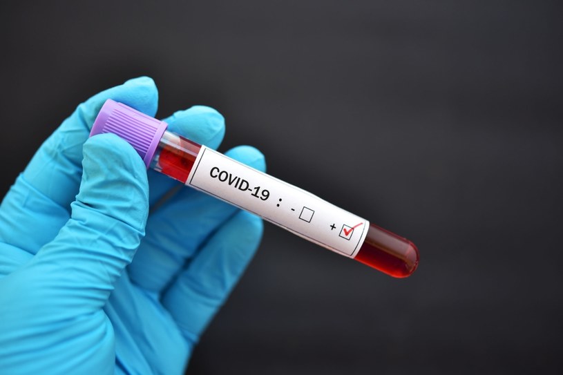 COVID-19 to choroba wywoływana przez SARS-CoV-2 /123RF/PICSEL