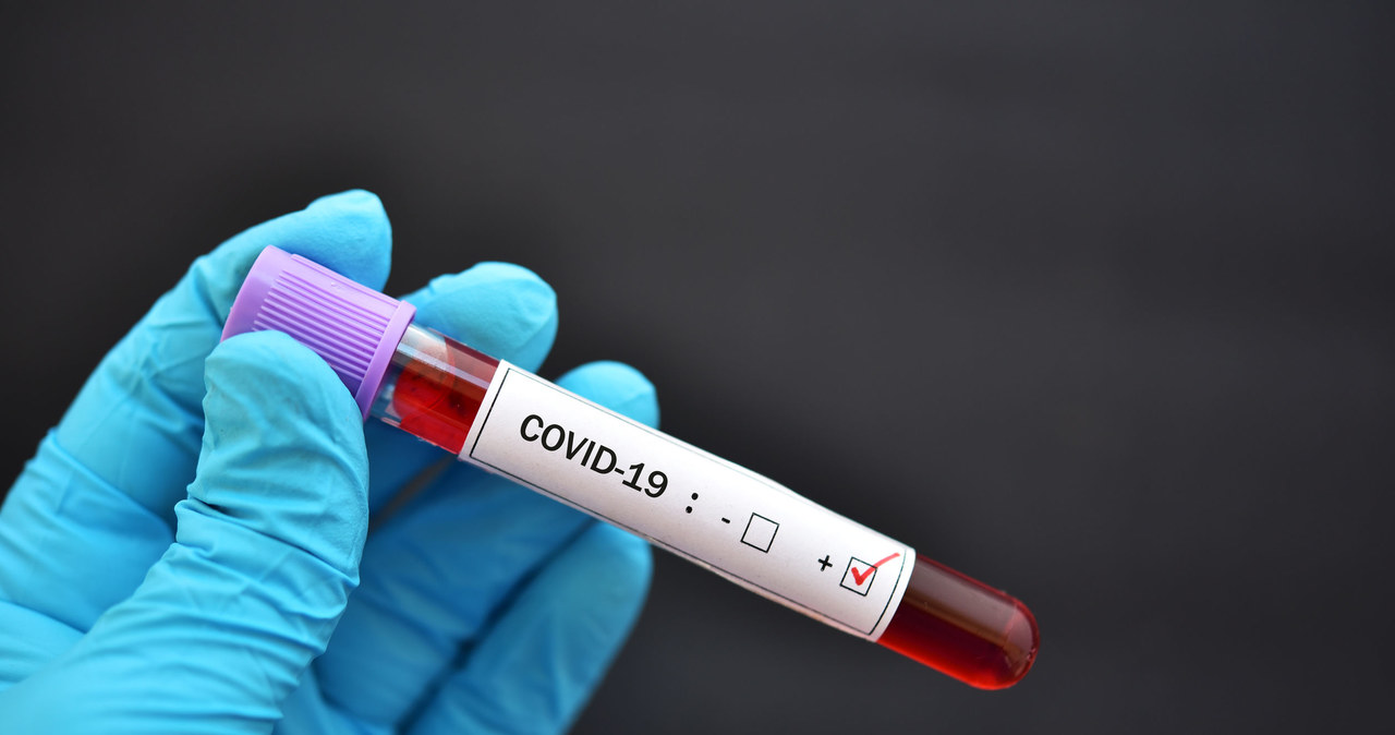 COVID-19 to choroba wywoływana przez SARS-CoV-2 /123RF/PICSEL