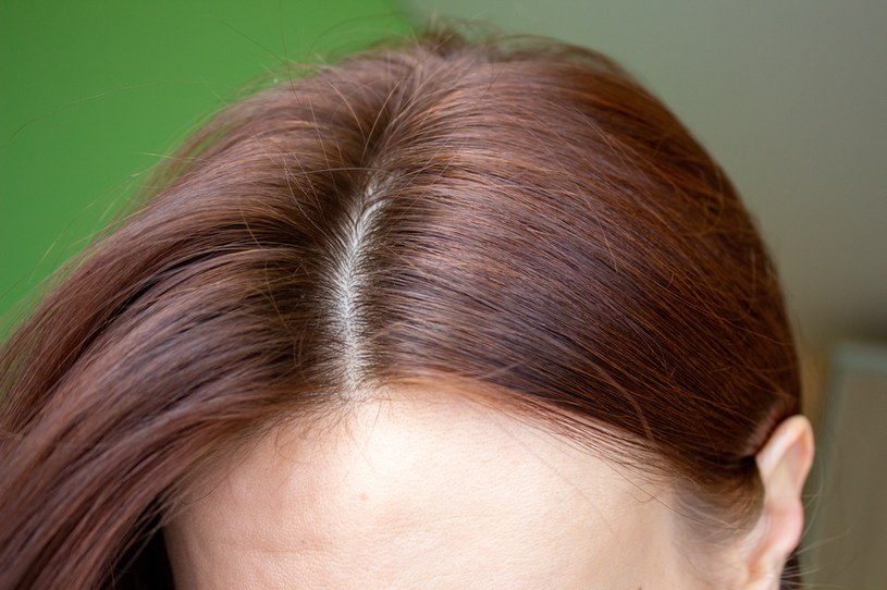 COVID-19 wpływa na wypadanie włosów /123RF/PICSEL