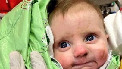 Cudowne ocalenie: 2-miesięczne niemowlę uratowane w Turcji po 128 godzinach