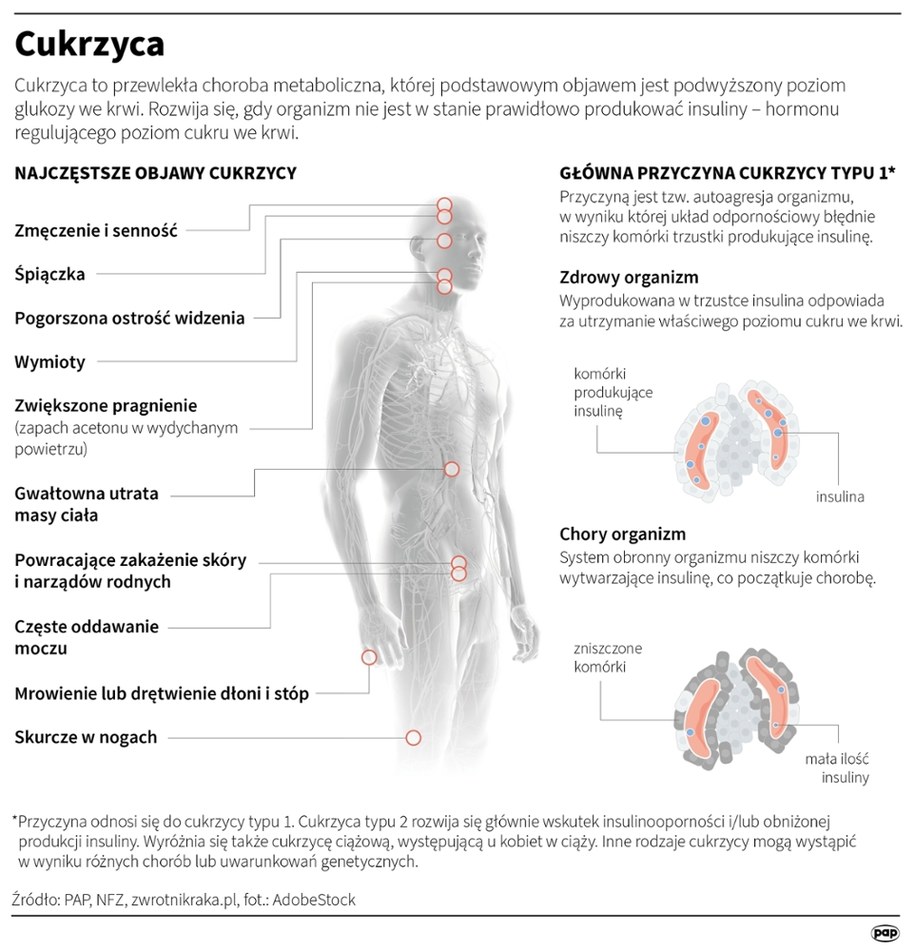 Cukrzyca to przewlekła choroba metaboliczna, której podstawowym objawem jest podwyższony poziom glukozy we krwi /Mateusz Krymski /PAP