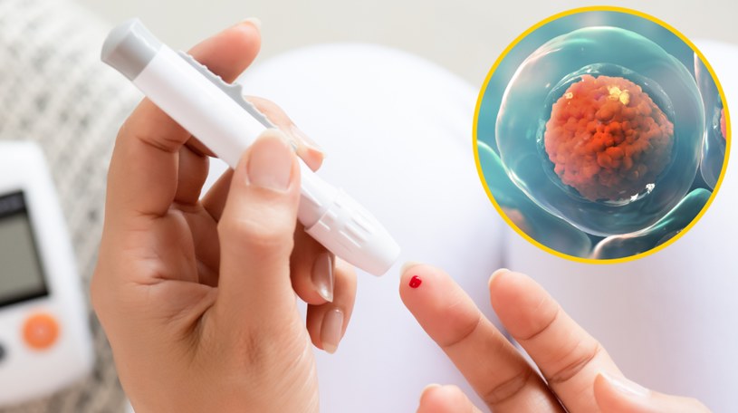 Cukrzycę będziemy leczyć komórkami macierzystymi z żołądka? Niezwykłe odkrycie naukowców /123RF/PICSEL /123RF/PICSEL