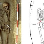 "Cyborg" z VI wieku. Znaleziono szkielet mężczyzny z nożem zamiast ręki
