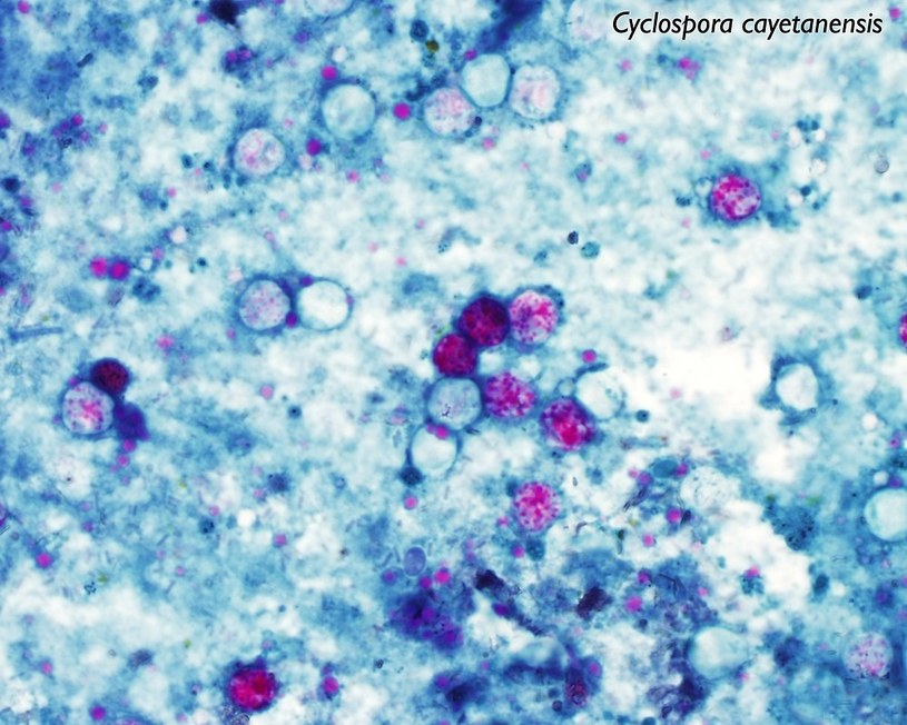 Cyclospora cayetanensis /materiały prasowe