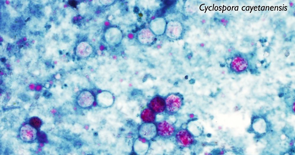 Cyclospora cayetanensis /materiały prasowe