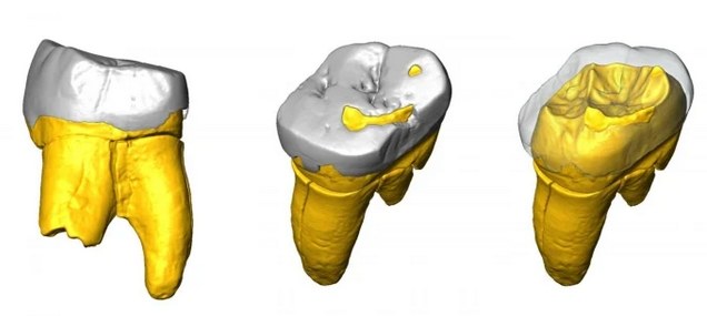 Cyfrowy model zębu Stajnia S5000 /materiały prasowe