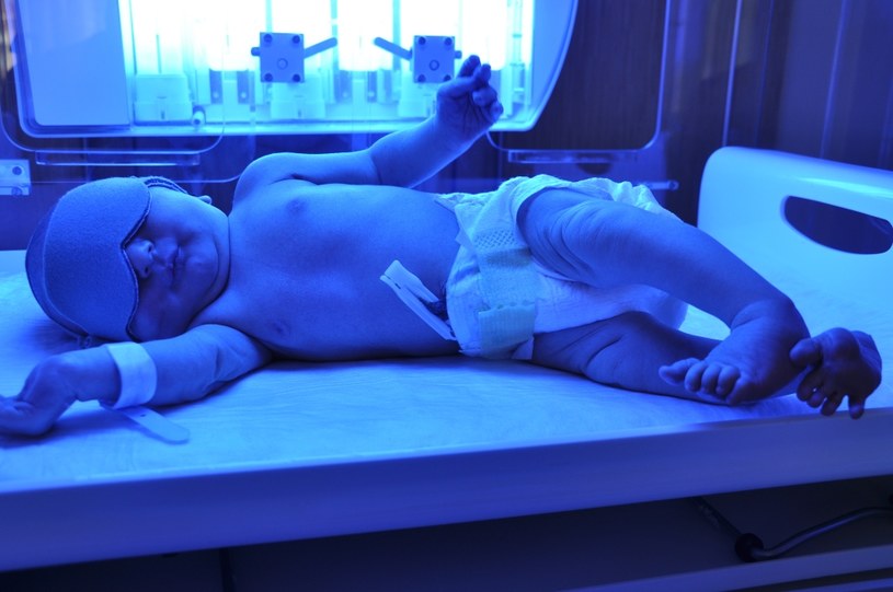 Czasem żółtaczka noworodków wymaga wdrożenia procedur leczniczych /123RF/PICSEL