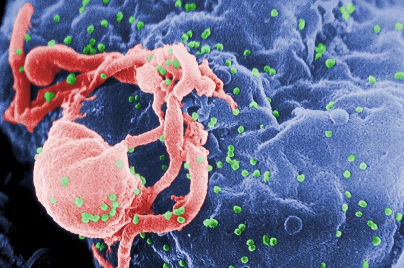 Cząsteczki wirusa HIV atakują komórkę - tu zaznaczone na zielono /materiały prasowe