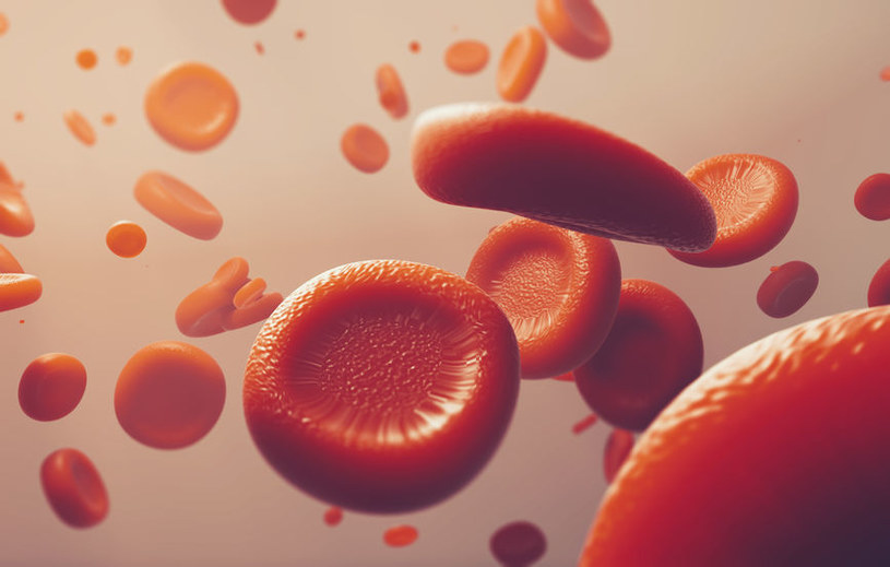 Czerwienica to podstępna choroba krwi, która może prowadzić do białaczki /123RF/PICSEL