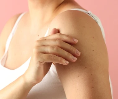 Czerwone kropki na ciele to nie pieprzyki. Co oznaczają rubinki? 