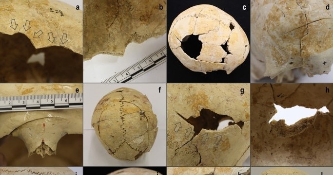Część czaszek przeanalizowanych w badaniach z widocznymi urazami wywołanymi uderzeniem kamiennych narzędzi /Fernández-Crespo, T., Ordoño, J., Etxeberria, F. et al. Large-scale violence in Late Neolithic Western Europe based on expanded skeletal evidence from San Juan ante Portam Latinam. Sci Rep 13, 17103 ( /materiał zewnętrzny