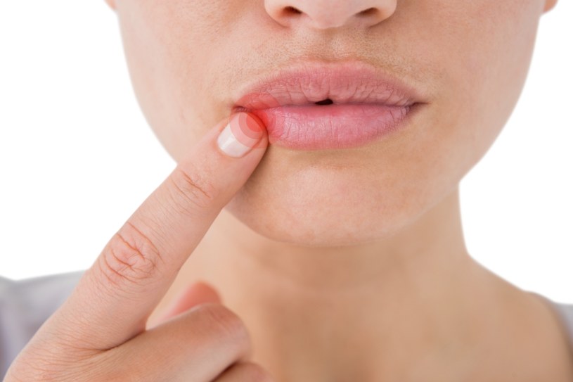 Częste oblizywanie ust, niedobory witamin, palenie tytoniu mogą zwiększać ryzyko pojawiania się zajadów /123RF/PICSEL