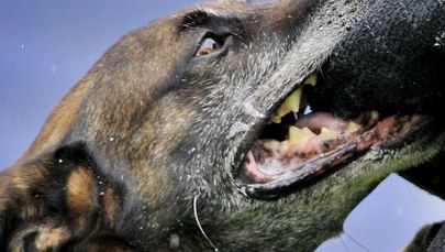 Czteroletni chłopiec pogryziony przez psy. Dziecko trafiło do szpitala