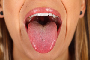 Czujesz posmak krwi w ustach? Przebadaj zatoki, dziąsła i jelita 