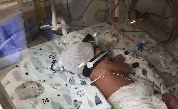 Czworaczki urodziły się w Poznaniu. Takie porody zdarzają się raz na 700 tysięcy