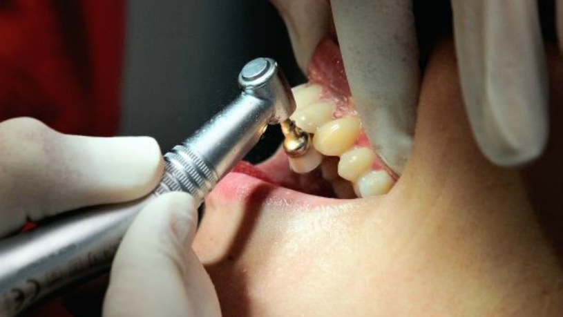 Czy dentystyki można nauczyć się oglądając tutoriale na YouTube? /materiały prasowe