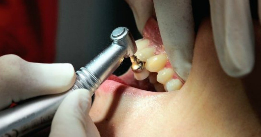 Czy dentystyki można nauczyć się oglądając tutoriale na YouTube? /materiały prasowe