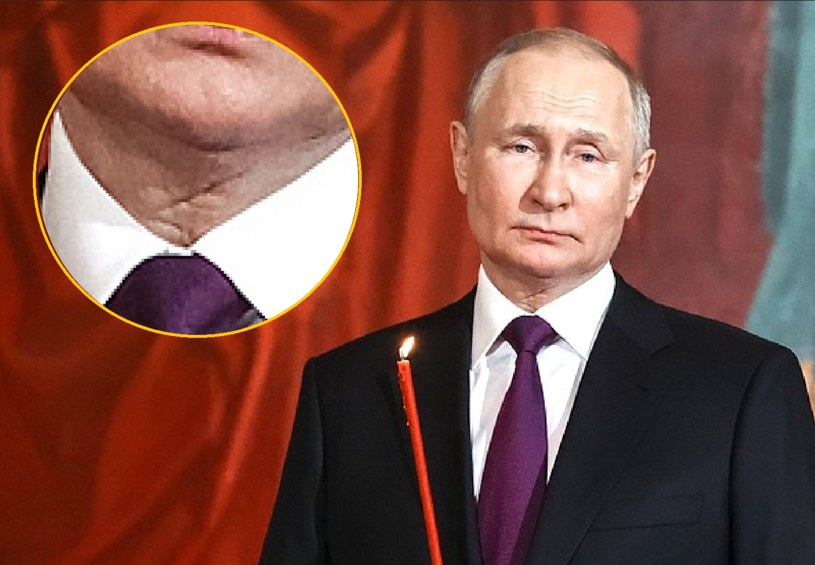 Czy dziwna blizna to efekt operacji onkologicznej, którą przeszedł Putin? / źródło: kremlin.ru /domena publiczna