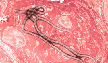 Czy jesteśmy przygotowani na kolejną epidemię wirusa Ebola?