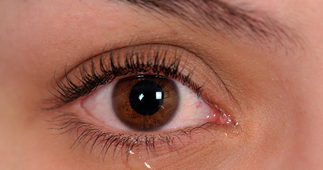 Czy koronawirus może być przenoszony przez łzy? Tego jeszcze nie wiadomo /123RF/PICSEL