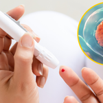 Czy lekarstwem na cukrzycę będą komórki macierzyste pochodzące z żołądka?