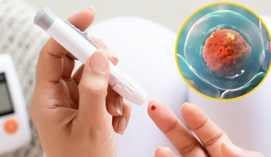 Czy lekarstwem na cukrzycę będą komórki macierzyste pochodzące z żołądka?