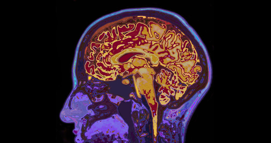 Czy mózg może produkować fruktozę? Zaskakujące wyniki badań /123RF/PICSEL