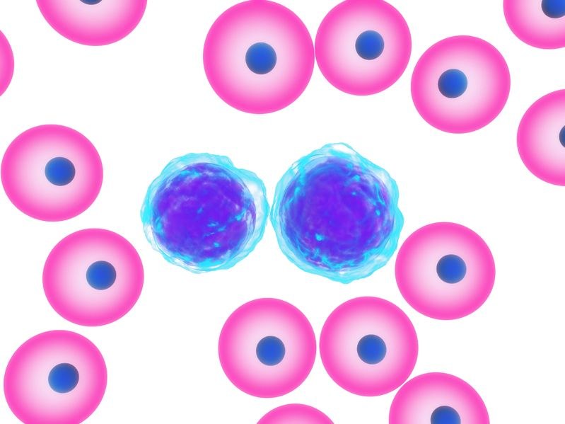 Czy nowotwory kiedyś uda się pokonać? Elotuzumab może pomóc w walce ze szpiczakiem plazmocytowym /123RF/PICSEL