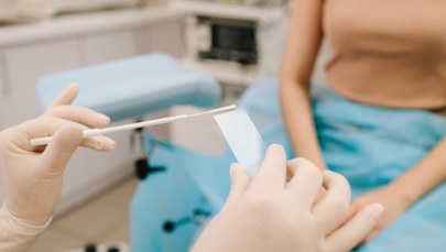 Czy pamiętałaś o tym w styczniu? Profilaktyka ratuje życie