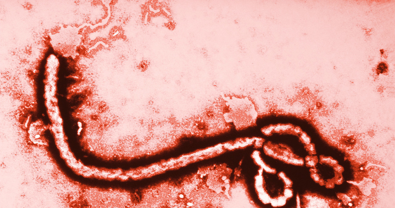 Czy sztuczna inteligencja pomoże odkrywać wirusy tak niebezpieczne jak Ebola (na zdjęciu)? /© Glowimages