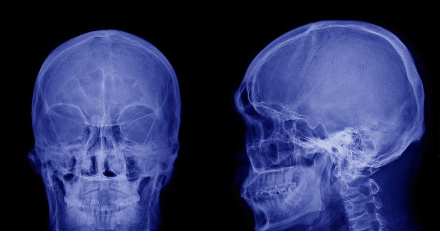 Czy terapia firmy Bioquark pozwoli ożywić martwy mózg? /123RF/PICSEL