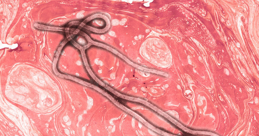 Czy uda nam się uniknąć przyszłej epidemii wirusa Ebola? /123RF/PICSEL