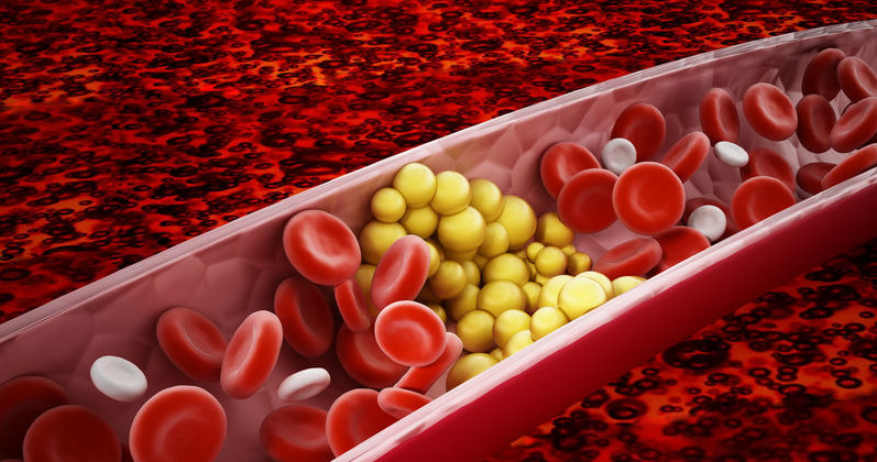 Czym jest cholesterol i jakie pełni funkcje? /&copy;123RF/PICSEL