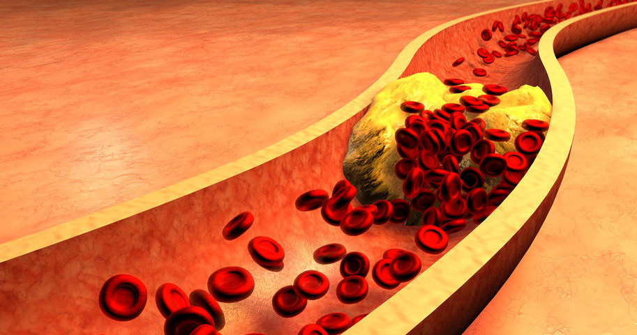 Czym jest cholesterol i skąd bierze się w organizmie? /&copy;123RF/PICSEL