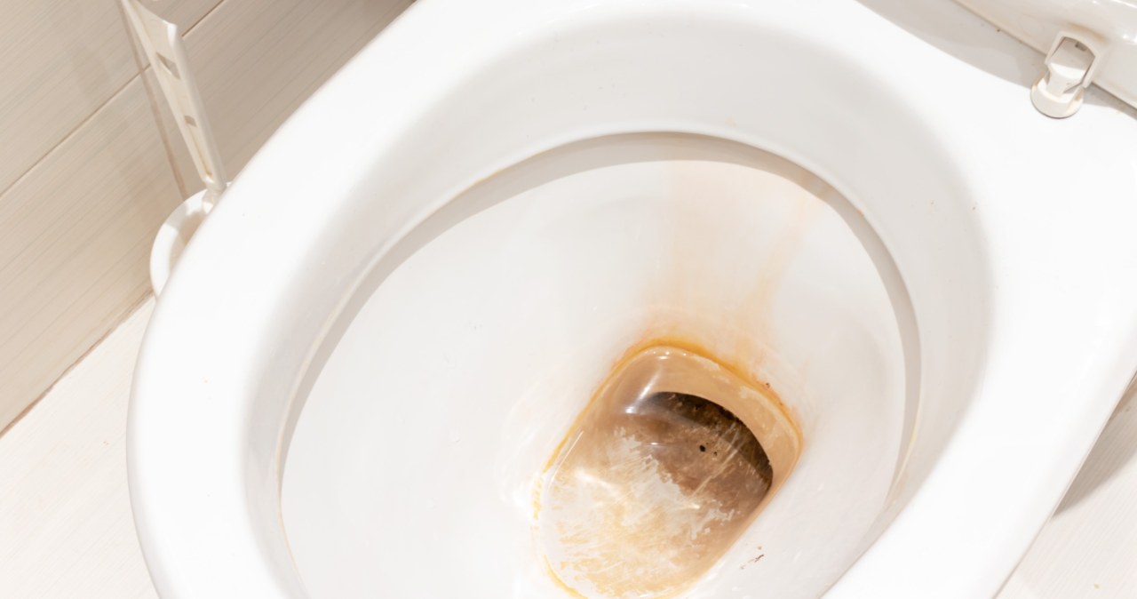 Czym usunąć zacieki w toalecie? /123RF/PICSEL