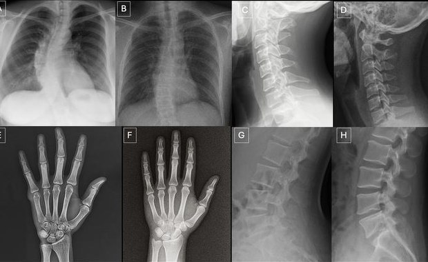 Deepfake w medycynie. Sztuczna inteligencja myli nawet specjalistów