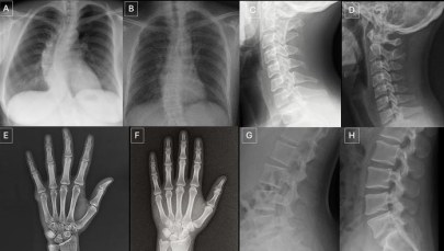 Deepfake w medycynie. Sztuczna inteligencja myli nawet specjalistów