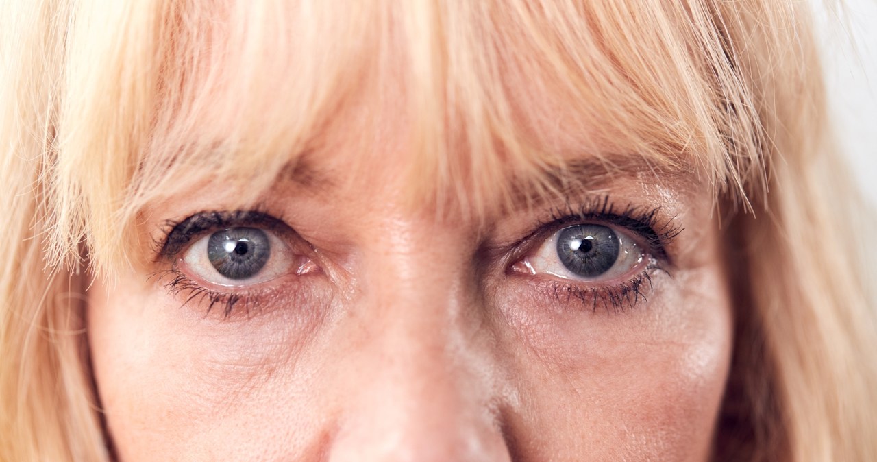 Delikatna skóra wokół oczy często w pierwszej kolejności może zdradzać problemy ze zdrowiem /123RF/PICSEL