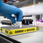 Deltakron. Badacze z Cypru mówią o nowym wariancie SARS-CoV-2