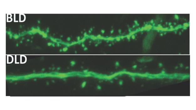 Dendryty komórek szczurów trzymanych w przyciemnionym świetle (DLD) mają znacznie mniej odbierających bodźce kolców /Michigan State University /Materiały prasowe