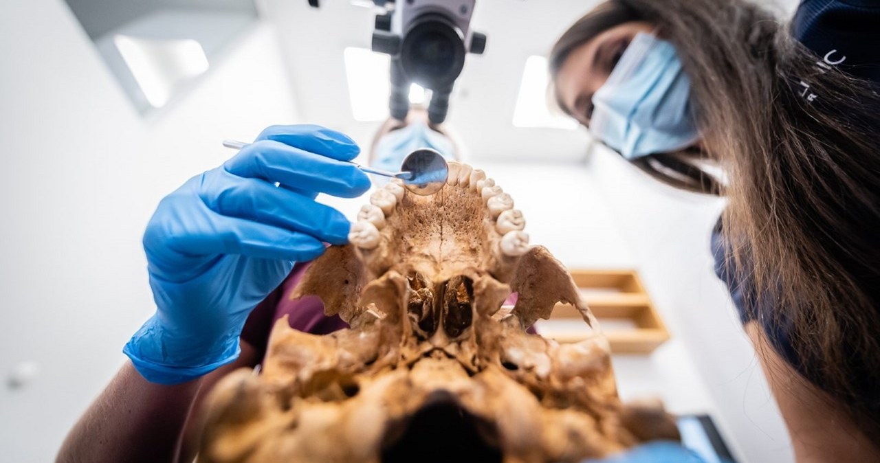 Dentyści zbadali zęby średniowiecznych „wampirów” /Dentim Clinic Medicover /materiały prasowe