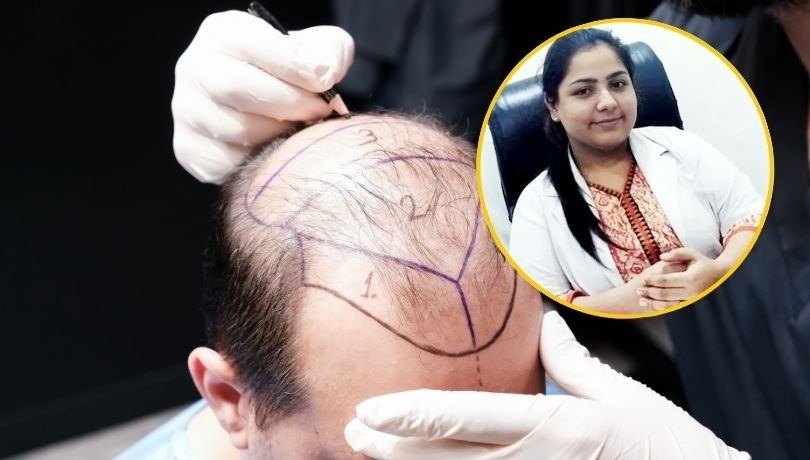 Dentystka z Indii została aresztowana z powodu śmierci dwóch osób. Miała przeprowadzić u nich operację transplantacji włosów. /Shutterstock