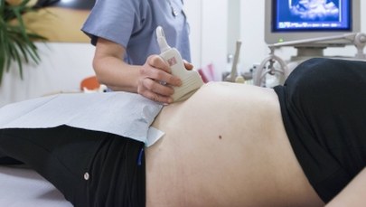 "DGP": Ciąża pod ścisłym nadzorem