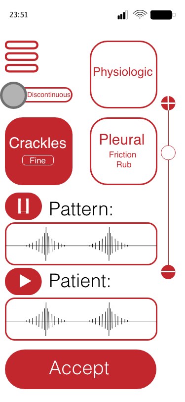 Diagnostykę wesprze specjalna aplikacja: lekarz będzie mógł porównać to, co słyszy (u dołu), ze wzorcem (u góry) /Materiały udostępnione nam przez twórców cyfrowego stetoskopu /