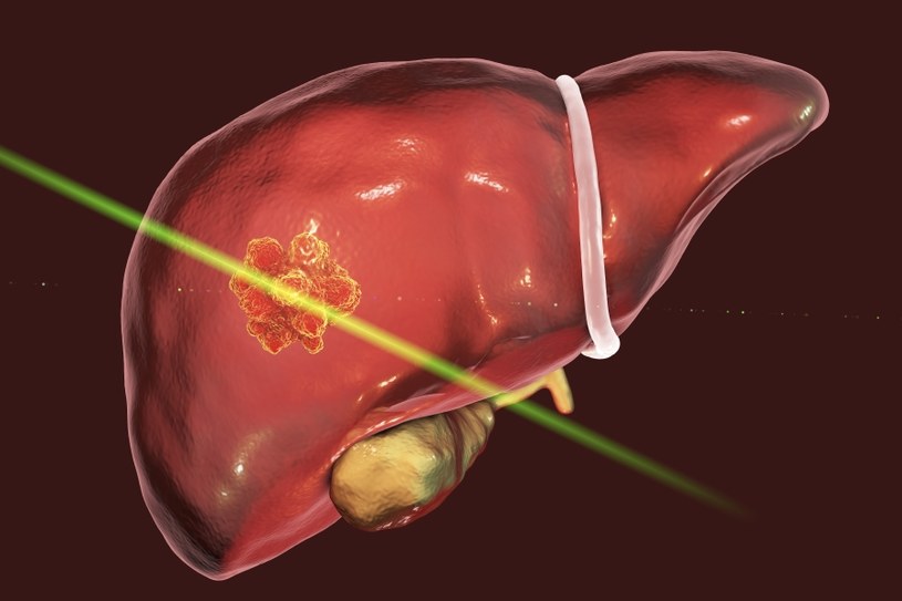 Diagnozę ułatwi USG /&copy;123RF/PICSEL