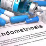 ​Dlaczego endometrioza jest dokuczliwa?