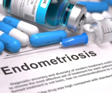 ​Dlaczego endometrioza jest dokuczliwa?